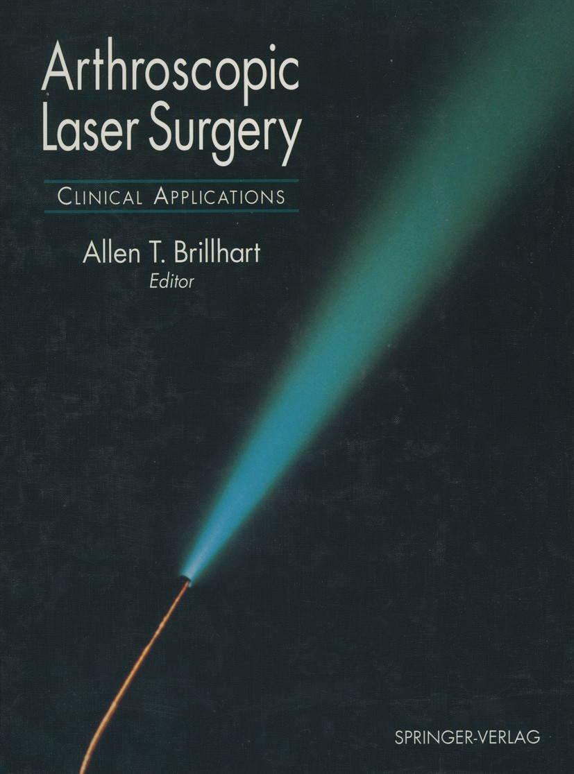 Titlebook: Arthroscopic Laser Surgery; Clinical Application Allen T. Brillhart Book 1995 Springer-Verlag New York Inc. 1995 Laser.Laser Surgery.Surger Titlebook: Arthroscopic Laser Surgery; Clinical Application Allen T. Brillhart Book 1995 Springer-Verlag New York Inc. 1995 Laser.Laser Surgery.Surger