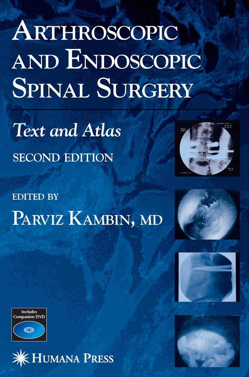 Titlebook: Arthroscopic and Endoscopic Spinal Surgery; Text and Atlas Parviz Kambin (Professor Orthopedic Surgery and En Book 2005Latest edition Human Titlebook: Arthroscopic and Endoscopic Spinal Surgery; Text and Atlas Parviz Kambin (Professor Orthopedic Surgery and En Book 2005Latest edition Human