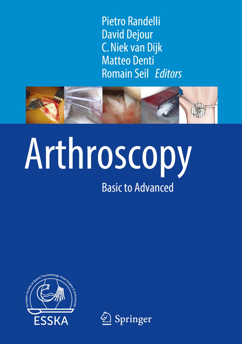 Titlebook: Arthroscopy; Basic to Advanced Pietro Randelli,David Dejour,Romain Seil Book 2016 The Editor(s) (if applicable) and The Author(s), under ex Titlebook: Arthroscopy; Basic to Advanced Pietro Randelli,David Dejour,Romain Seil Book 2016 The Editor(s) (if applicable) and The Author(s), under ex