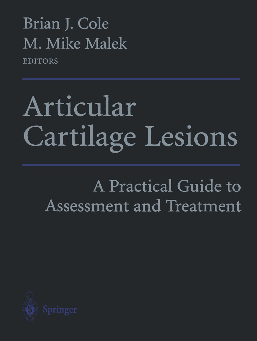Titlebook: Articular Cartilage Lesions; A Practical Guide to Brian J. Cole,M. Mike Malek Book 2004 Springer Science+Business Media New York 2004 arthr Titlebook: Articular Cartilage Lesions; A Practical Guide to Brian J. Cole,M. Mike Malek Book 2004 Springer Science+Business Media New York 2004 arthr