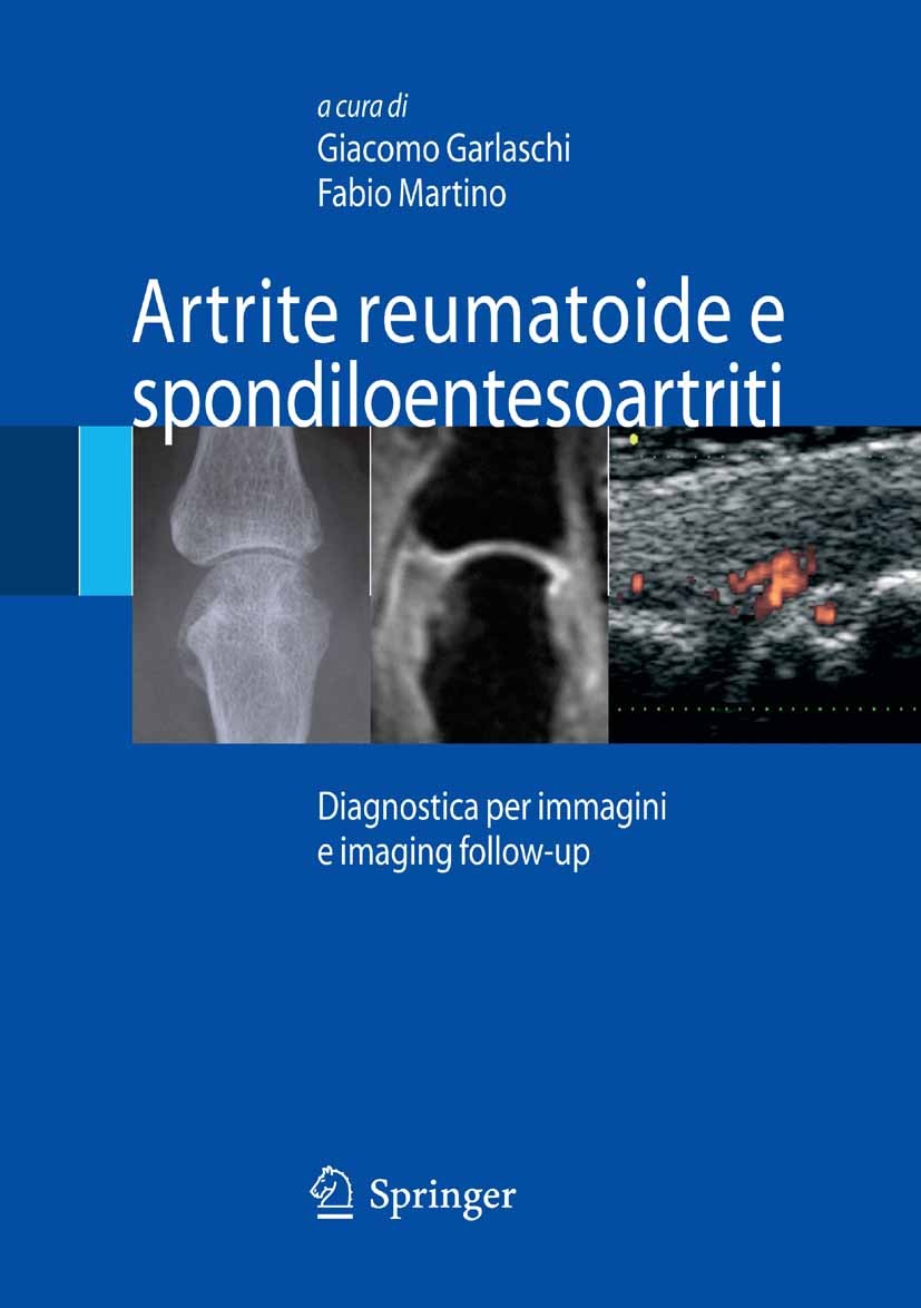 Titlebook: Artrite reumatoide e spondiloentesoartriti; Diagnostica per imma Giacomo Garlaschi,Fabio Martino Book 2007 Springer-Verlag Milan 2007 Arthr Titlebook: Artrite reumatoide e spondiloentesoartriti; Diagnostica per imma Giacomo Garlaschi,Fabio Martino Book 2007 Springer-Verlag Milan 2007 Arthr
