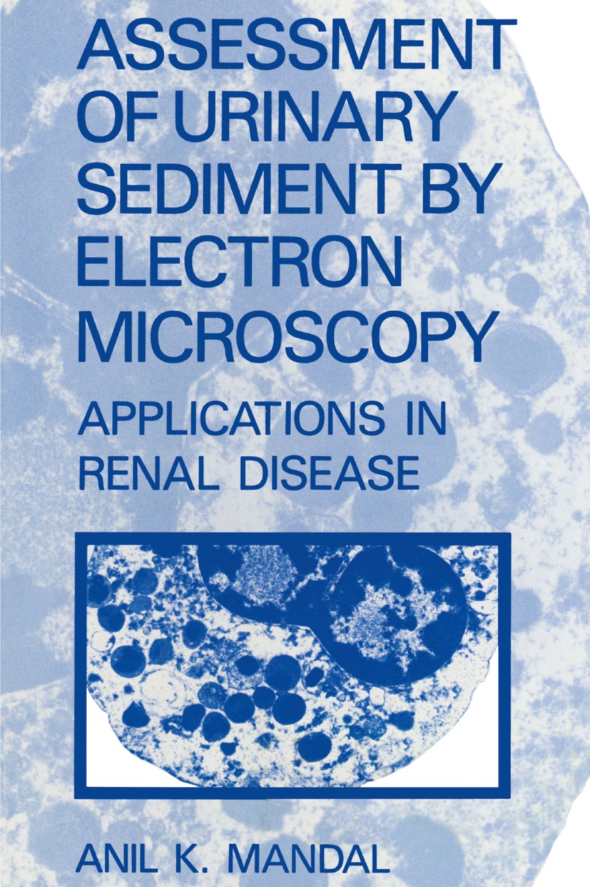 Titlebook: Assessment of Urinary Sediment by Electron Microscopy; Applications in Rena Anil K. Mandal Book 1987 Plenum Publishing Corporation 1987 ass Titlebook: Assessment of Urinary Sediment by Electron Microscopy; Applications in Rena Anil K. Mandal Book 1987 Plenum Publishing Corporation 1987 ass