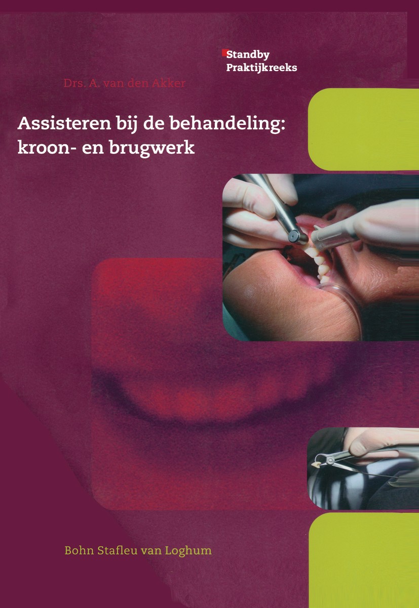Titlebook: Assisteren bij de behandeling:kroon- en brugwerk; A. Akker Book 2006Latest edition Bohn Stafleu van Loghum 2006 Titlebook: Assisteren bij de behandeling:kroon- en brugwerk; A. Akker Book 2006Latest edition Bohn Stafleu van Loghum 2006