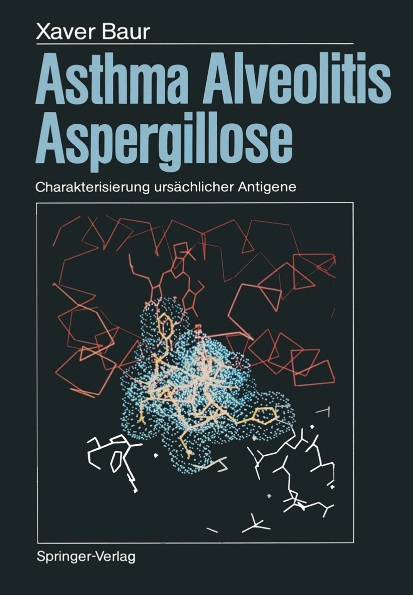 Titlebook: Asthma, Alveolitis, Aspergillose; Charakterisierung ur Xaver Baur Book 1986 Springer-Verlag Berlin Heidelberg 1986 Antigen.Asthma.Immunglob Titlebook: Asthma, Alveolitis, Aspergillose; Charakterisierung ur Xaver Baur Book 1986 Springer-Verlag Berlin Heidelberg 1986 Antigen.Asthma.Immunglob