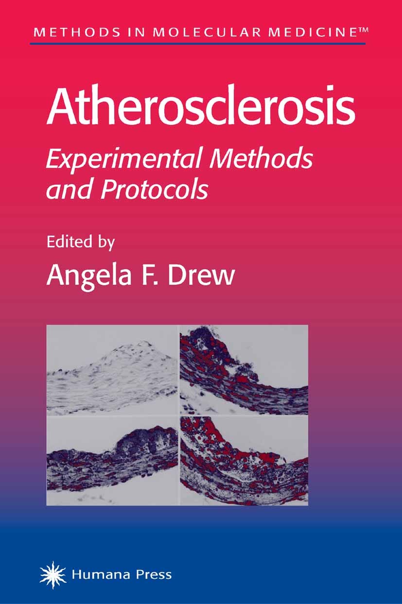 Titlebook: Atherosclerosis; Experimental Methods Angela F. Drew Book 2001 Humana Press 2001 Titlebook: Atherosclerosis; Experimental Methods Angela F. Drew Book 2001 Humana Press 2001