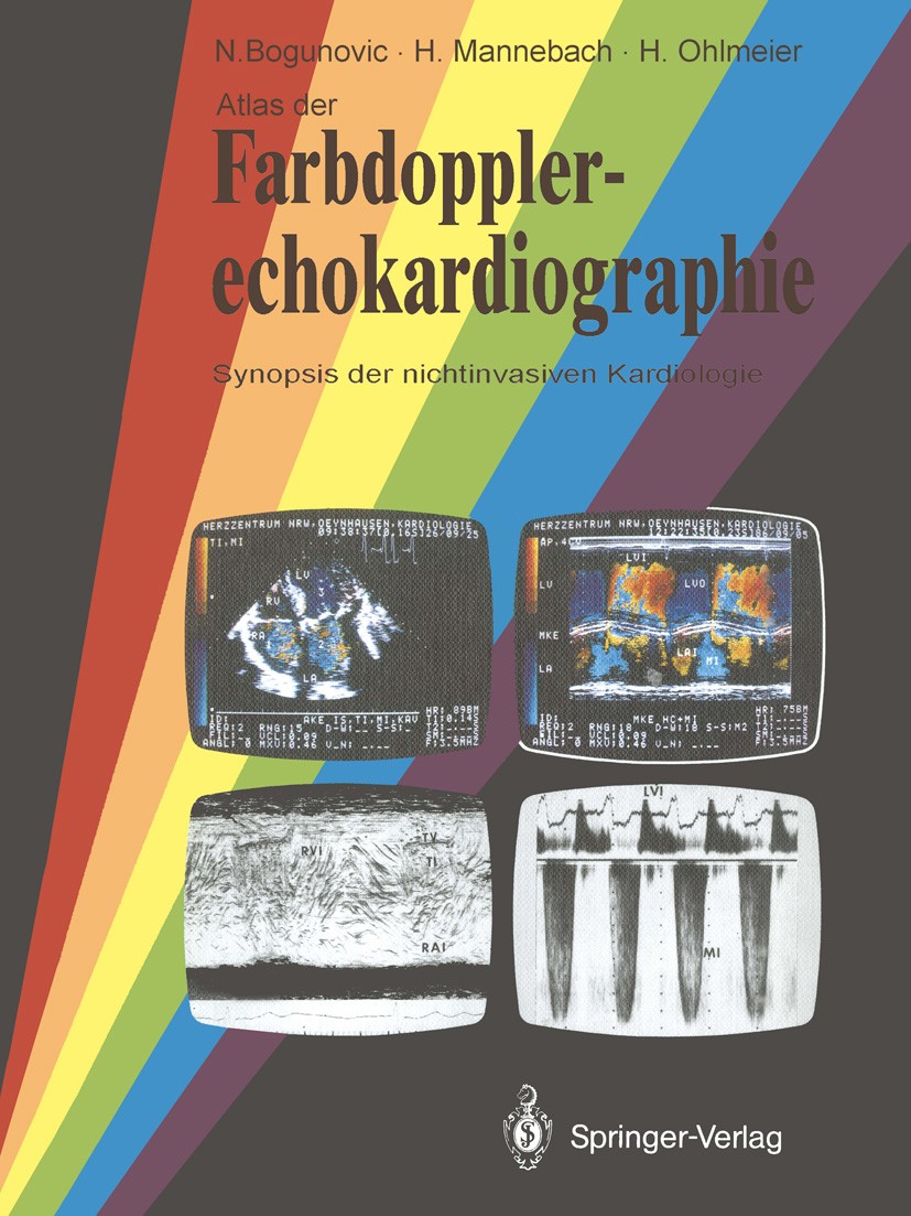 Titlebook: Atlas der Farbdopplerechokardiographie; Synopsis der nichtin Nikola Bogunovic,Hermann Mannebach,Harm Ohlmeier Book 1988 Springer-Verlag Ber Titlebook: Atlas der Farbdopplerechokardiographie; Synopsis der nichtin Nikola Bogunovic,Hermann Mannebach,Harm Ohlmeier Book 1988 Springer-Verlag Ber