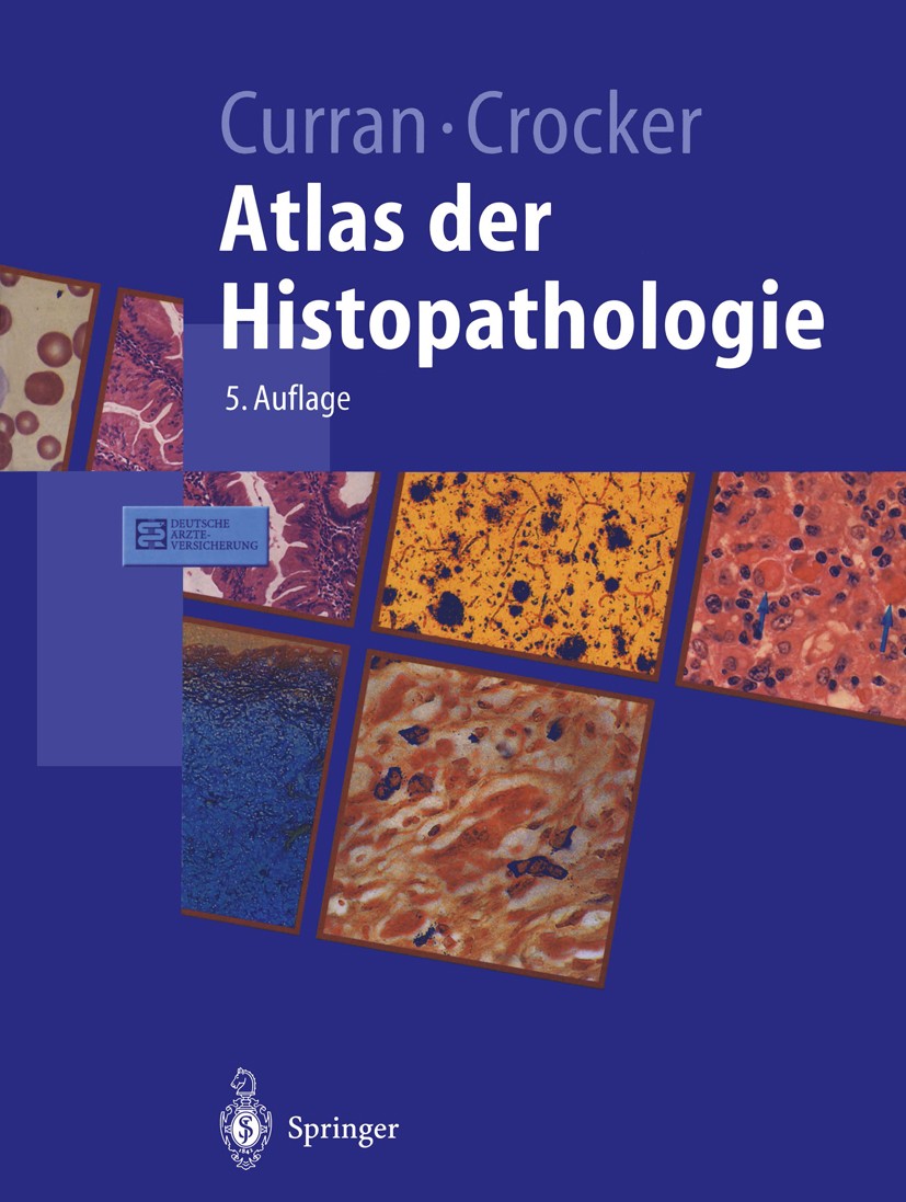 Titlebook: Atlas der Histopathologie; R. C. Curran,J. Crocker Textbook 2001Latest edition Springer-Verlag Berlin Heidelberg 2001 Haut.Histologie.Hist Titlebook: Atlas der Histopathologie; R. C. Curran,J. Crocker Textbook 2001Latest edition Springer-Verlag Berlin Heidelberg 2001 Haut.Histologie.Hist