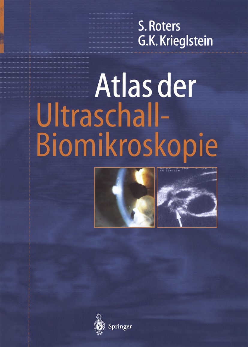 Titlebook: Atlas der Ultraschall-Biomikroskopie; Sigrid Roters,Günter K. Krieglstein Book 2001 Springer-Verlag Berlin Heidelberg 2001 Auge.Diagnostik Titlebook: Atlas der Ultraschall-Biomikroskopie; Sigrid Roters,Günter K. Krieglstein Book 2001 Springer-Verlag Berlin Heidelberg 2001 Auge.Diagnostik