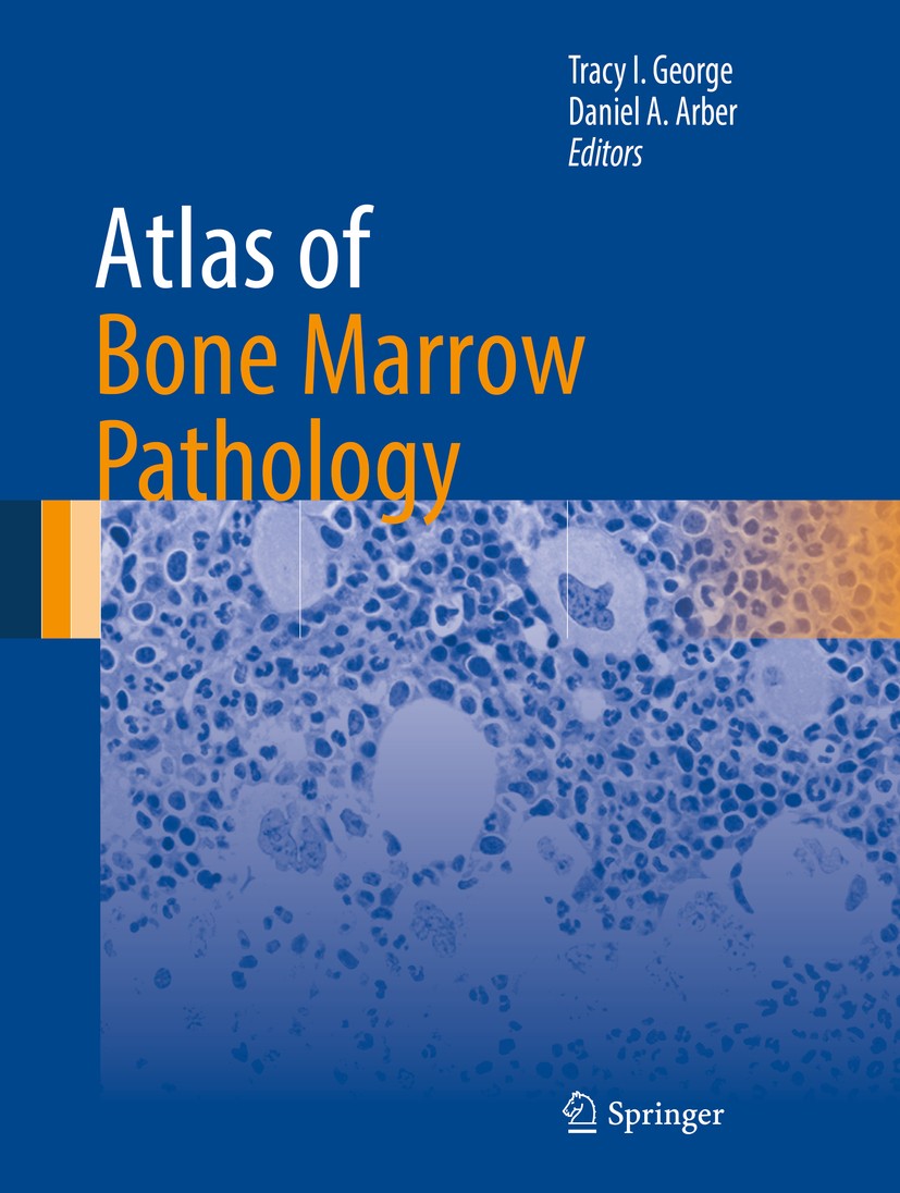 Titlebook: Atlas of Bone Marrow Pathology; Tracy I. George,Daniel A. Arber Book 2018 Springer Science+Business Media, LLC 2018 Cryptococcus.Erythroid Titlebook: Atlas of Bone Marrow Pathology; Tracy I. George,Daniel A. Arber Book 2018 Springer Science+Business Media, LLC 2018 Cryptococcus.Erythroid