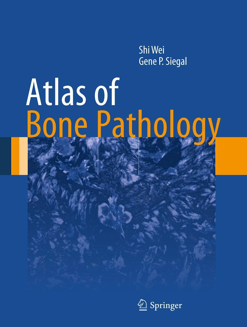 Titlebook: Atlas of Bone Pathology; Shi Wei,Gene P. Siegal Book 2013 Springer Science+Business Media New York 2013 Adamantinoma.Chondroblastoma.Chord Titlebook: Atlas of Bone Pathology; Shi Wei,Gene P. Siegal Book 2013 Springer Science+Business Media New York 2013 Adamantinoma.Chondroblastoma.Chord