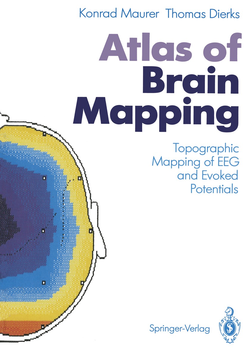 Titlebook: Atlas of Brain Mapping; Topographic Mapping Konrad Maurer,Thomas Dierks Book 1991 Springer-Verlag Berlin Heidelberg 1991 Brain Mapping.EEG Titlebook: Atlas of Brain Mapping; Topographic Mapping Konrad Maurer,Thomas Dierks Book 1991 Springer-Verlag Berlin Heidelberg 1991 Brain Mapping.EEG