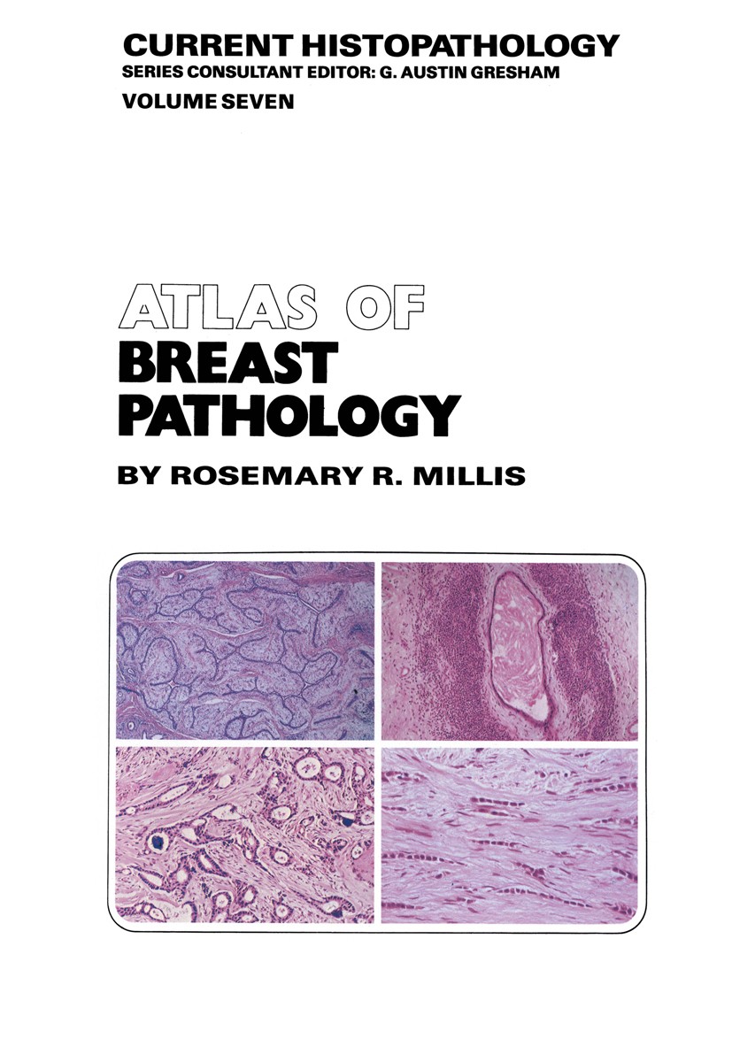 Titlebook: Atlas of Breast Pathology; Rosemary R. Millis Book 1984 Rosemary R. Millis 1984 pathology Titlebook: Atlas of Breast Pathology; Rosemary R. Millis Book 1984 Rosemary R. Millis 1984 pathology