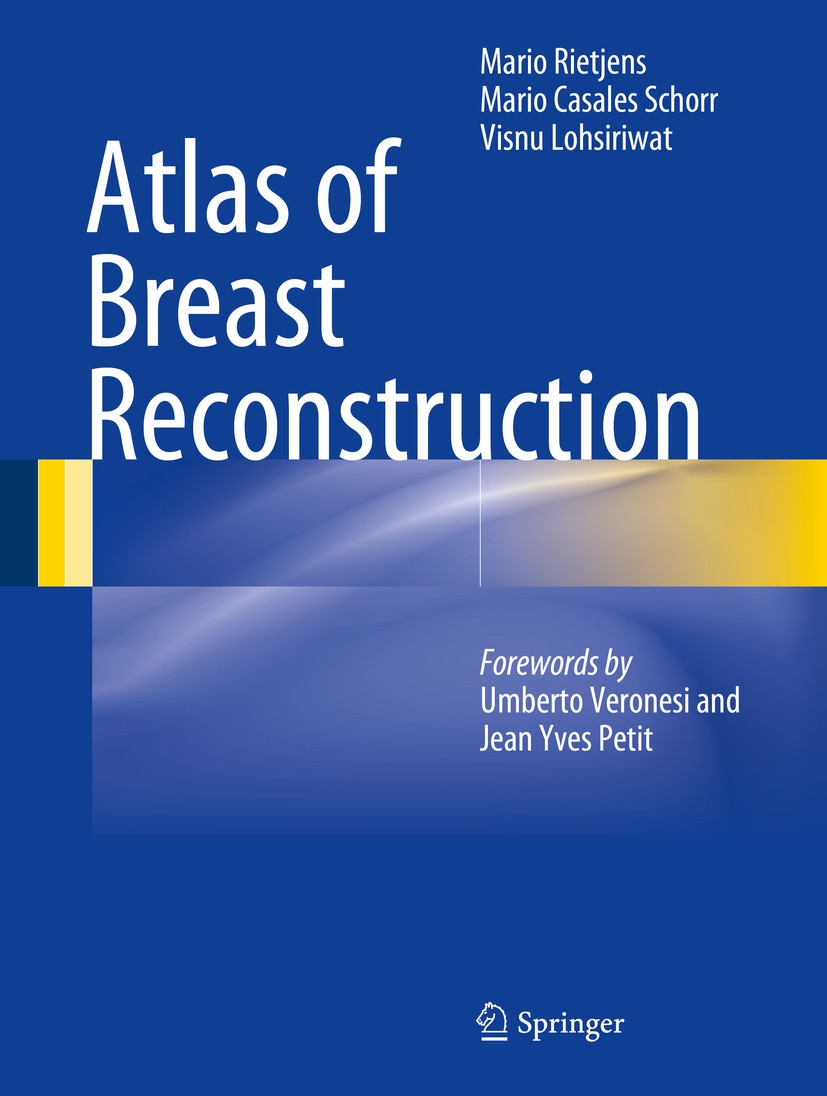 Titlebook: Atlas of Breast Reconstruction; Mario Rietjens,Mario Casales Schorr,Visnu Lohsiriw Book 2015 Springer-Verlag Italia 2015 breast cancer.bre Titlebook: Atlas of Breast Reconstruction; Mario Rietjens,Mario Casales Schorr,Visnu Lohsiriw Book 2015 Springer-Verlag Italia 2015 breast cancer.bre