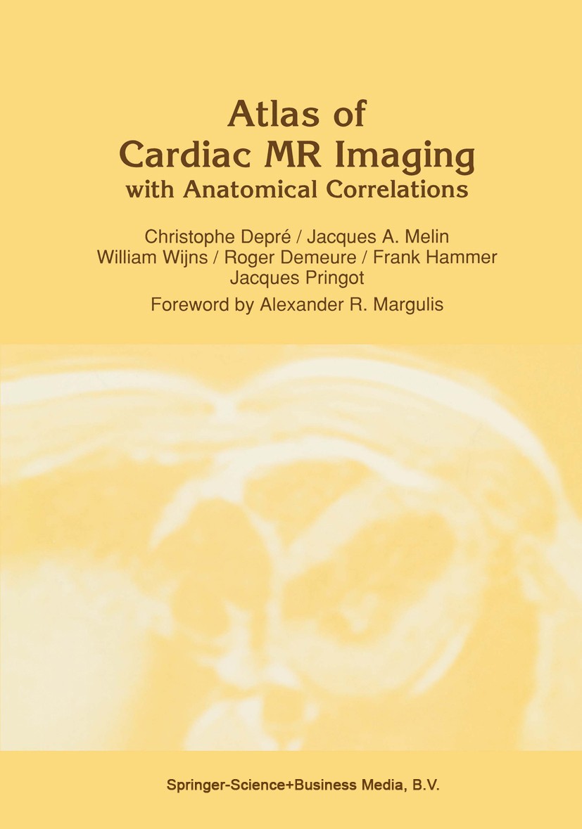 Titlebook: Atlas of Cardiac MR Imaging with Anatomical Correlations; Christophe Depré,Jacques A. Melin,Jacques Pringot Book 1991 Springer Science+Bus Titlebook: Atlas of Cardiac MR Imaging with Anatomical Correlations; Christophe Depré,Jacques A. Melin,Jacques Pringot Book 1991 Springer Science+Bus