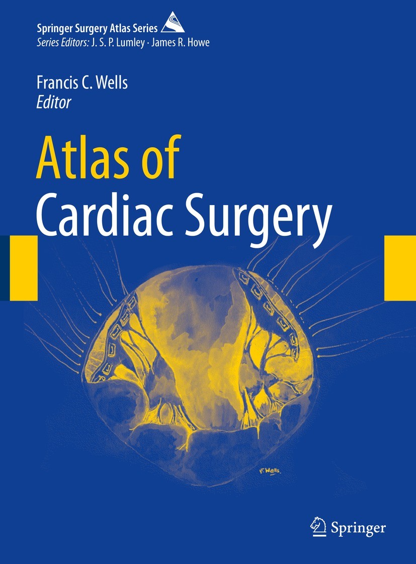 Titlebook: Atlas of Cardiac Surgery; Francis C. Wells Book 2023 The Editor(s) (if applicable) and The Author(s), under exclusive license to Springer Titlebook: Atlas of Cardiac Surgery; Francis C. Wells Book 2023 The Editor(s) (if applicable) and The Author(s), under exclusive license to Springer