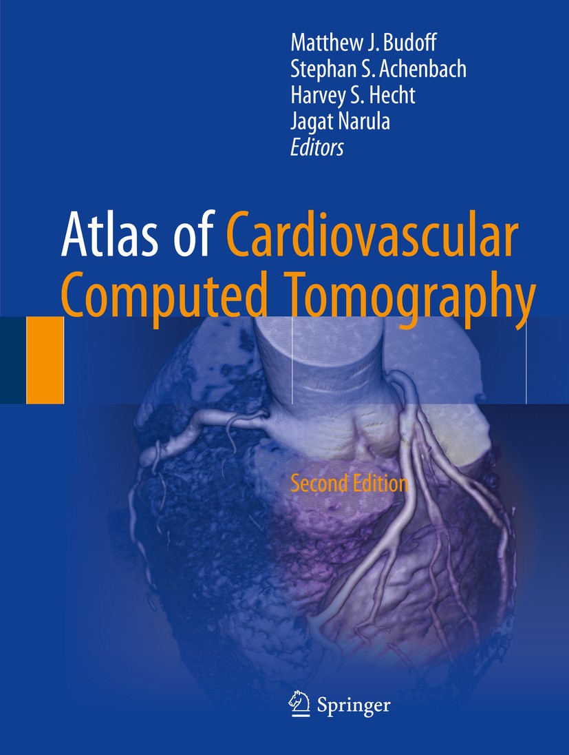 Titlebook: Atlas of Cardiovascular Computed Tomography; Matthew J. Budoff,Stephan S. Achenbach,Jagat Narul Book 2018Latest edition Springer-Verlag Lo Titlebook: Atlas of Cardiovascular Computed Tomography; Matthew J. Budoff,Stephan S. Achenbach,Jagat Narul Book 2018Latest edition Springer-Verlag Lo