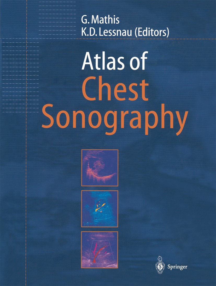 Titlebook: Atlas of Chest Sonography; Gebhard Mathis,Klaus Dieter Lessnau Book 20031st edition Springer-Verlag Berlin Heidelberg 2003 Tumor.chest.com Titlebook: Atlas of Chest Sonography; Gebhard Mathis,Klaus Dieter Lessnau Book 20031st edition Springer-Verlag Berlin Heidelberg 2003 Tumor.chest.com