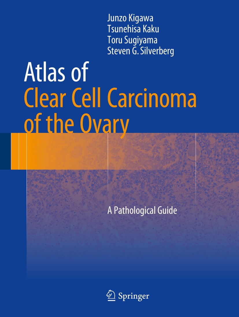 Titlebook: Atlas of Clear Cell Carcinoma of the Ovary; A Pathological Guide Junzo Kigawa,Tsunehisa Kaku,Steven G Silverberg Book 2015 Springer Japan 2 Titlebook: Atlas of Clear Cell Carcinoma of the Ovary; A Pathological Guide Junzo Kigawa,Tsunehisa Kaku,Steven G Silverberg Book 2015 Springer Japan 2