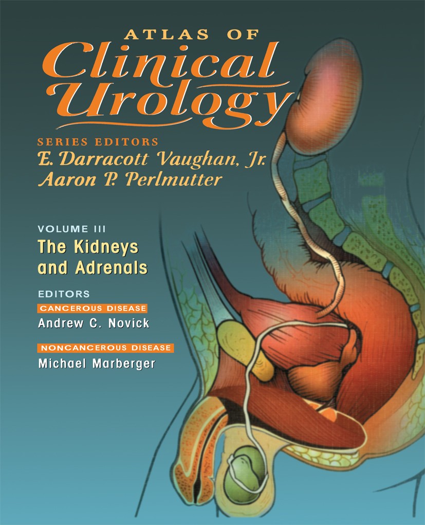 Titlebook: Atlas of Clinical Urology; The Kidneys and Adre Andrew C. Novick (Chairman),Michael Marberger (Pro Book 2000 Springer Science+Business Medi Titlebook: Atlas of Clinical Urology; The Kidneys and Adre Andrew C. Novick (Chairman),Michael Marberger (Pro Book 2000 Springer Science+Business Medi