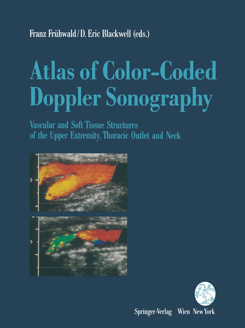 Titlebook: Atlas of Color-Coded Doppler Sonography; Vascular and Soft Ti Franz X. J. Frühwald (Assistant Professor of Radio Book 1992 Springer-Verlag Titlebook: Atlas of Color-Coded Doppler Sonography; Vascular and Soft Ti Franz X. J. Frühwald (Assistant Professor of Radio Book 1992 Springer-Verlag