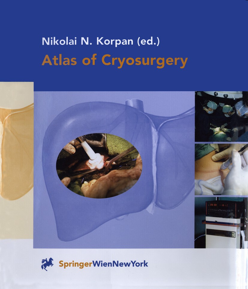 Titlebook: Atlas of Cryosurgery; Nikolai N. Korpan (Professor of Surgery Head, Vice Book 2001 Springer-Verlag Wien 2001 Chirurgie.Cryochirurgie.Cryot Titlebook: Atlas of Cryosurgery; Nikolai N. Korpan (Professor of Surgery Head, Vice Book 2001 Springer-Verlag Wien 2001 Chirurgie.Cryochirurgie.Cryot