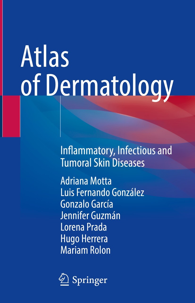 Titlebook: Atlas of Dermatology; Inflammatory, Infect Adriana Motta,Luis Fernando González,Mariam Rolon Book 2022 Springer Nature Switzerland AG 2022 Titlebook: Atlas of Dermatology; Inflammatory, Infect Adriana Motta,Luis Fernando González,Mariam Rolon Book 2022 Springer Nature Switzerland AG 2022