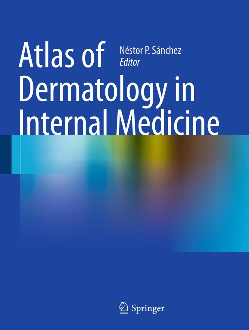 Titlebook: Atlas of Dermatology in Internal Medicine; Néstor P. Sánchez Book 2012 Springer Science+Business Media, LLC 2012 Cutaneous Manifestations Titlebook: Atlas of Dermatology in Internal Medicine; Néstor P. Sánchez Book 2012 Springer Science+Business Media, LLC 2012 Cutaneous Manifestations