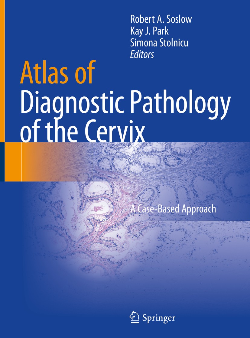 Titlebook: Atlas of Diagnostic Pathology of the Cervix; A Case-Based Approac Robert A. Soslow,Kay J. Park,Simona Stolnicu Book 2021 Springer Nature Sw Titlebook: Atlas of Diagnostic Pathology of the Cervix; A Case-Based Approac Robert A. Soslow,Kay J. Park,Simona Stolnicu Book 2021 Springer Nature Sw