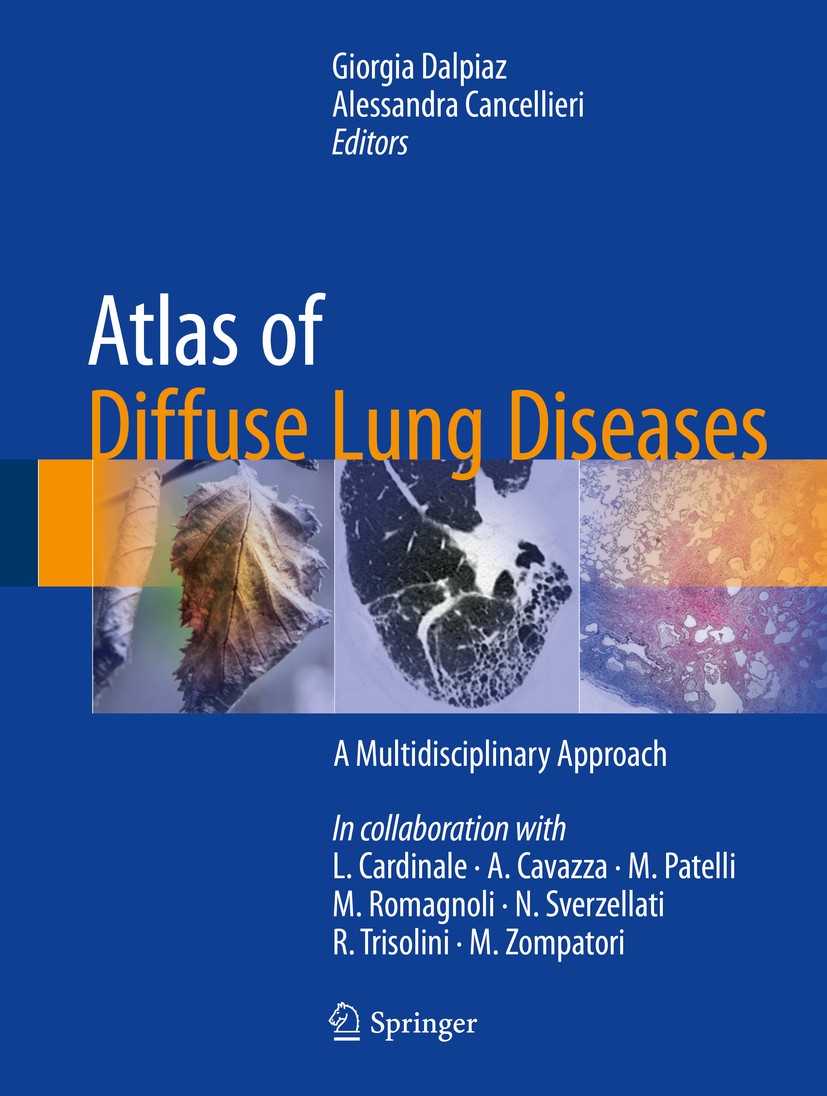 Titlebook: Atlas of Diffuse Lung Diseases; A Multidisciplinary Giorgia Dalpiaz,Alessandra Cancellieri Book 2017 Springer International Publishing Swi Titlebook: Atlas of Diffuse Lung Diseases; A Multidisciplinary Giorgia Dalpiaz,Alessandra Cancellieri Book 2017 Springer International Publishing Swi