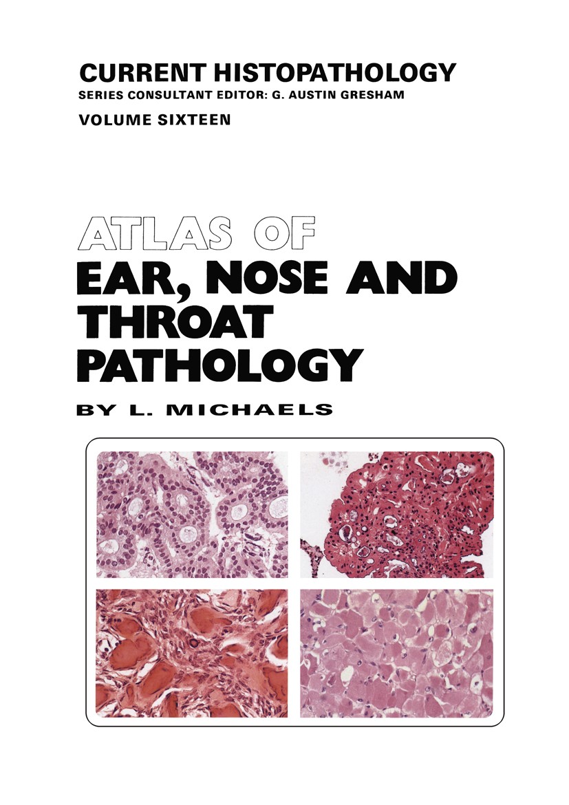 Titlebook: Atlas of Ear, Nose and Throat Pathology; L. Michaels Book 1990 L. Michaels 1990 pathology Titlebook: Atlas of Ear, Nose and Throat Pathology; L. Michaels Book 1990 L. Michaels 1990 pathology