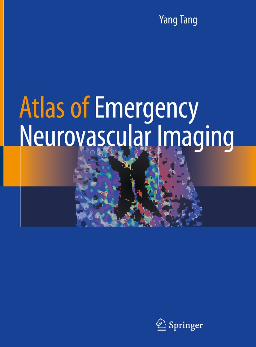 Titlebook: Atlas of Emergency Neurovascular Imaging; Yang Tang Book 2020 Springer Nature Switzerland AG 2020 Emergency CT perfusion.Emergency imaging Titlebook: Atlas of Emergency Neurovascular Imaging; Yang Tang Book 2020 Springer Nature Switzerland AG 2020 Emergency CT perfusion.Emergency imaging