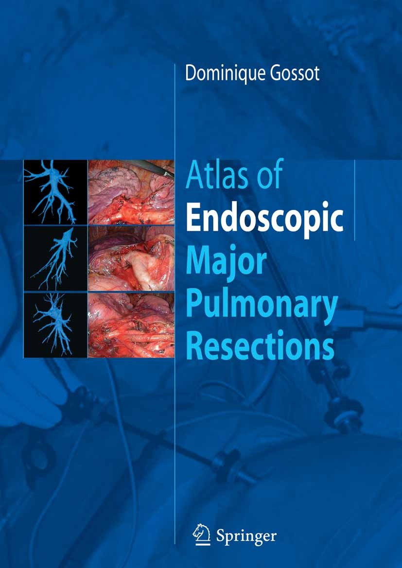 Titlebook: Atlas of endoscopic major pulmonary resections; Dominique Gossot Book 20101st edition Springer-Verlag Paris 2010 Pulmonary lobectomy.Pulmo Titlebook: Atlas of endoscopic major pulmonary resections; Dominique Gossot Book 20101st edition Springer-Verlag Paris 2010 Pulmonary lobectomy.Pulmo