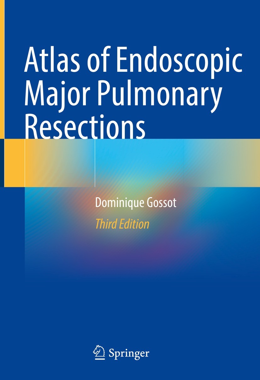 Titlebook: Atlas of Endoscopic Major Pulmonary Resections; Dominique Gossot Book 2021Latest edition The Editor(s) (if applicable) and The Author(s), Titlebook: Atlas of Endoscopic Major Pulmonary Resections; Dominique Gossot Book 2021Latest edition The Editor(s) (if applicable) and The Author(s),