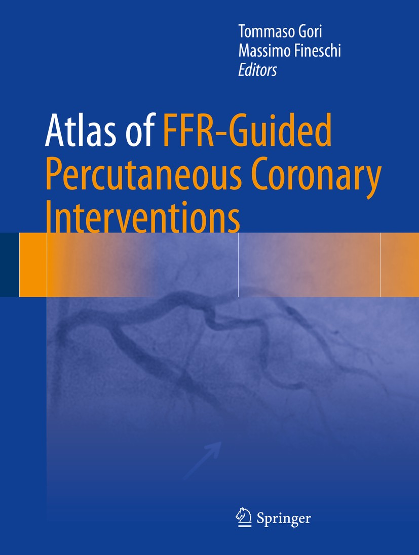 Titlebook: Atlas of FFR-Guided Percutaneous Coronary Interventions; Tommaso Gori,Massimo Fineschi Book 2016 Springer International Publishing AG 2016 Titlebook: Atlas of FFR-Guided Percutaneous Coronary Interventions; Tommaso Gori,Massimo Fineschi Book 2016 Springer International Publishing AG 2016
