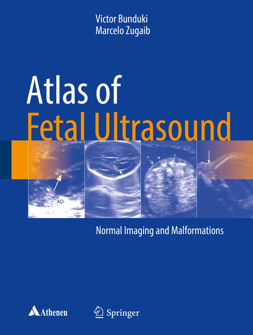 Titlebook: Atlas of Fetal Ultrasound; Normal Imaging and M Victor Bunduki,Marcelo Zugaib Book 2018 Springer International Publishing AG 2018 Fetal med Titlebook: Atlas of Fetal Ultrasound; Normal Imaging and M Victor Bunduki,Marcelo Zugaib Book 2018 Springer International Publishing AG 2018 Fetal med