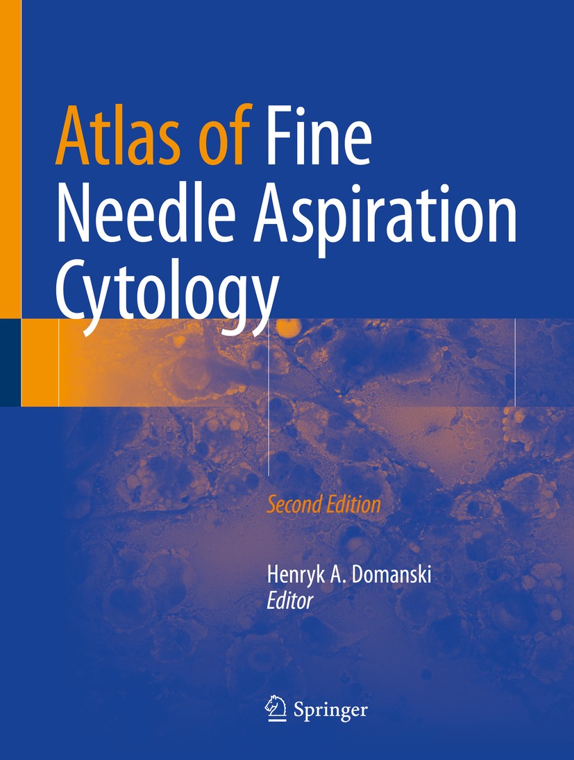 Titlebook: Atlas of Fine Needle Aspiration Cytology; Henryk A. Domanski Book 2019Latest edition Springer International Publishing AG, part of Springe Titlebook: Atlas of Fine Needle Aspiration Cytology; Henryk A. Domanski Book 2019Latest edition Springer International Publishing AG, part of Springe