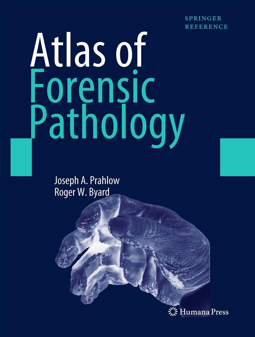 Titlebook: Atlas of Forensic Pathology; For Police, Forensic Joseph A. Prahlow,Roger W. Byard Reference work 2012 Springer Science+Business Media, LLC Titlebook: Atlas of Forensic Pathology; For Police, Forensic Joseph A. Prahlow,Roger W. Byard Reference work 2012 Springer Science+Business Media, LLC