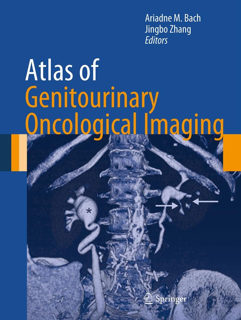 Titlebook: Atlas of Genitourinary Oncological Imaging; Ariadne M Bach,Jingbo Zhang Book 2013 Springer Science+Business Media New York 2013 Cancer.Gen Titlebook: Atlas of Genitourinary Oncological Imaging; Ariadne M Bach,Jingbo Zhang Book 2013 Springer Science+Business Media New York 2013 Cancer.Gen