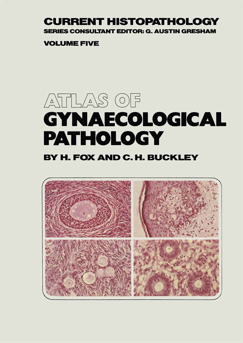 Titlebook: Atlas of Gynaecological Pathology; H. Fox,C. H. Buckley Book 1983 H. Fox and C. H. Buckley 1983 pathology Titlebook: Atlas of Gynaecological Pathology; H. Fox,C. H. Buckley Book 1983 H. Fox and C. H. Buckley 1983 pathology