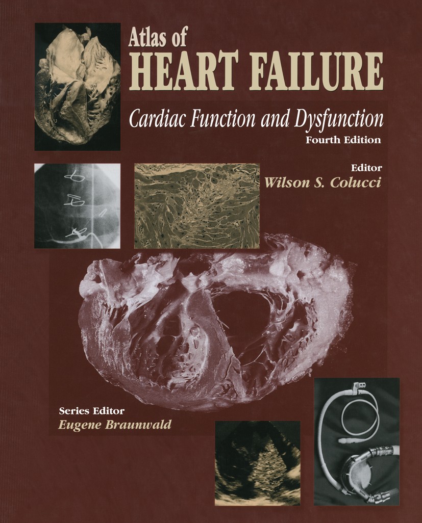 Titlebook: Atlas of HEART FAILURE; Cardiac Function and Wilson S. Colucci (Professor of Medicine, Chief) Book 2004Latest edition Springer Science+Busi Titlebook: Atlas of HEART FAILURE; Cardiac Function and Wilson S. Colucci (Professor of Medicine, Chief) Book 2004Latest edition Springer Science+Busi
