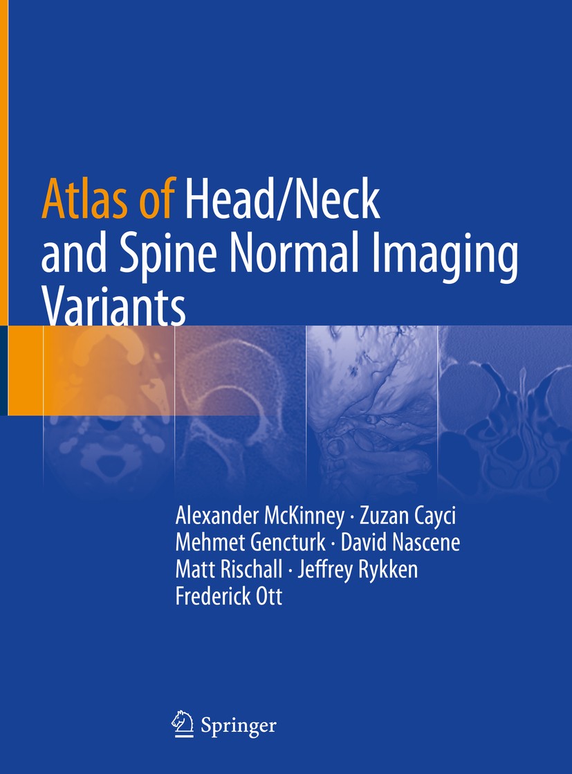 Titlebook: Atlas of Head/Neck and Spine Normal Imaging Variants; Alexander McKinney,Zuzan Cayci,Frederick Ott Book 2018 Springer Nature Switzerland A Titlebook: Atlas of Head/Neck and Spine Normal Imaging Variants; Alexander McKinney,Zuzan Cayci,Frederick Ott Book 2018 Springer Nature Switzerland A
