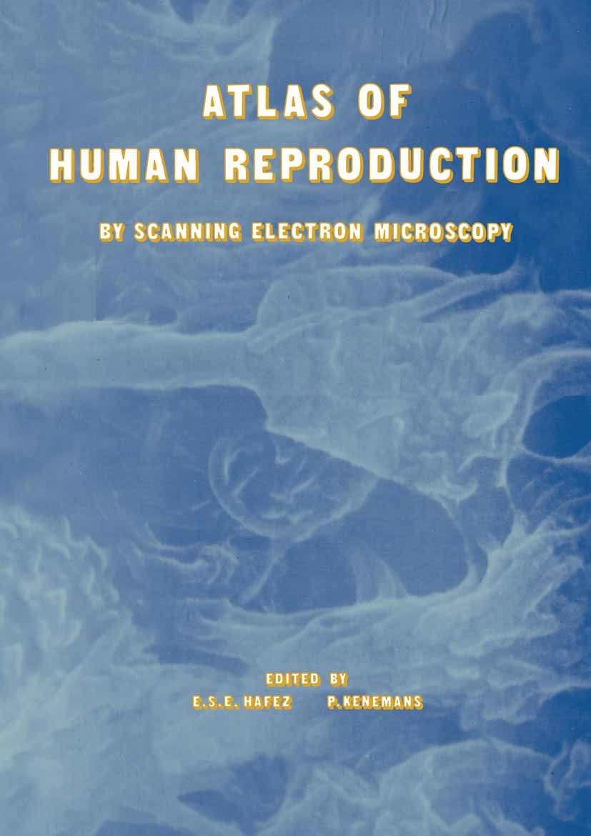 Titlebook: Atlas of Human Reproduction; By Scanning Electron E. S. E. Hafez,P. Kenemans Book 1982 MTP Press Limited 1982 reproduction Titlebook: Atlas of Human Reproduction; By Scanning Electron E. S. E. Hafez,P. Kenemans Book 1982 MTP Press Limited 1982 reproduction