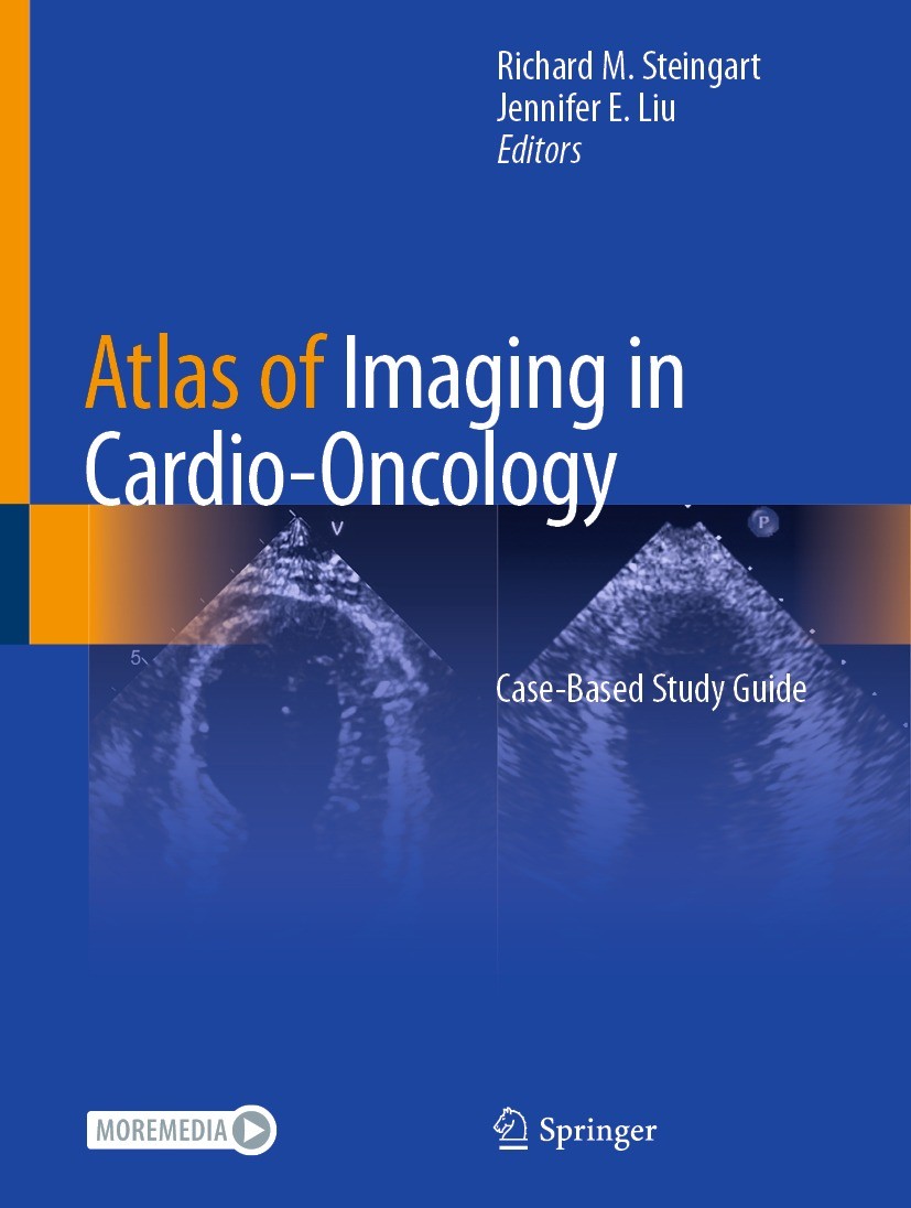 Titlebook: Atlas of Imaging in Cardio-Oncology; Case-Based Study Gui Richard M. Steingart,Jennifer E. Liu Book 2021 Springer Nature Switzerland AG 202 Titlebook: Atlas of Imaging in Cardio-Oncology; Case-Based Study Gui Richard M. Steingart,Jennifer E. Liu Book 2021 Springer Nature Switzerland AG 202