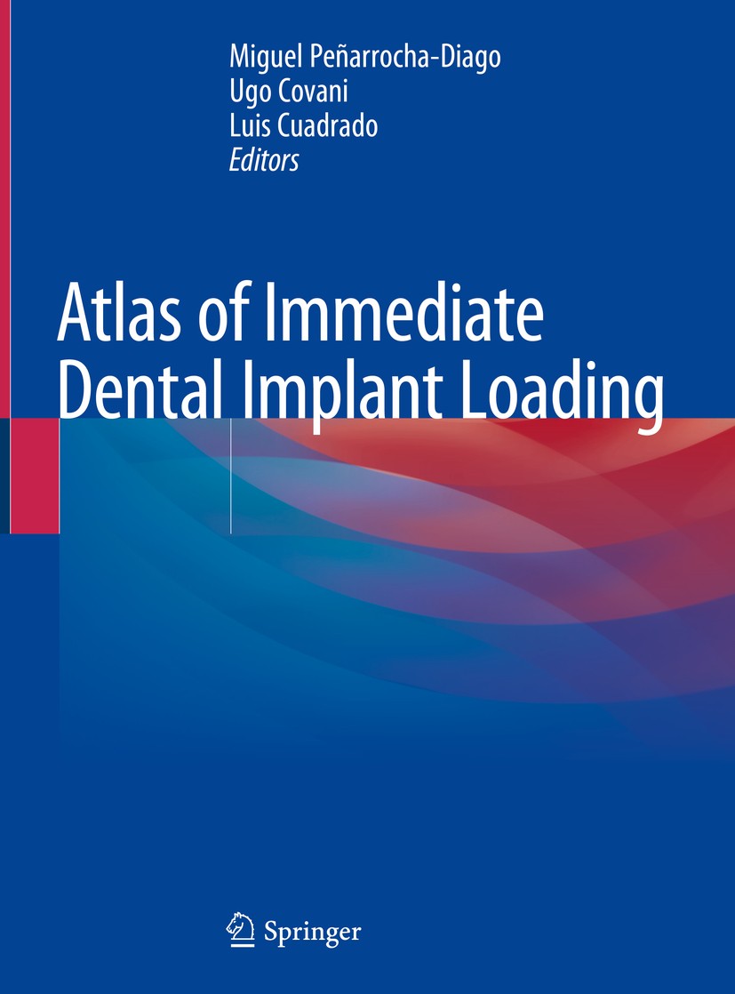 Titlebook: Atlas of Immediate Dental Implant Loading; Miguel Peñarrocha-Diago,Ugo Covani,Luis Cuadrado Book 2019 Springer Nature Switzerland AG 2019 Titlebook: Atlas of Immediate Dental Implant Loading; Miguel Peñarrocha-Diago,Ugo Covani,Luis Cuadrado Book 2019 Springer Nature Switzerland AG 2019