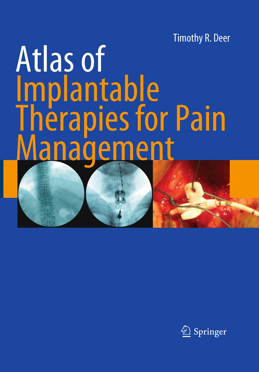 Titlebook: Atlas of Implantable Therapies for Pain Management; Timothy R. Deer Book 20111st edition Springer Science+Business Media, LLC 2011 anesthe Titlebook: Atlas of Implantable Therapies for Pain Management; Timothy R. Deer Book 20111st edition Springer Science+Business Media, LLC 2011 anesthe