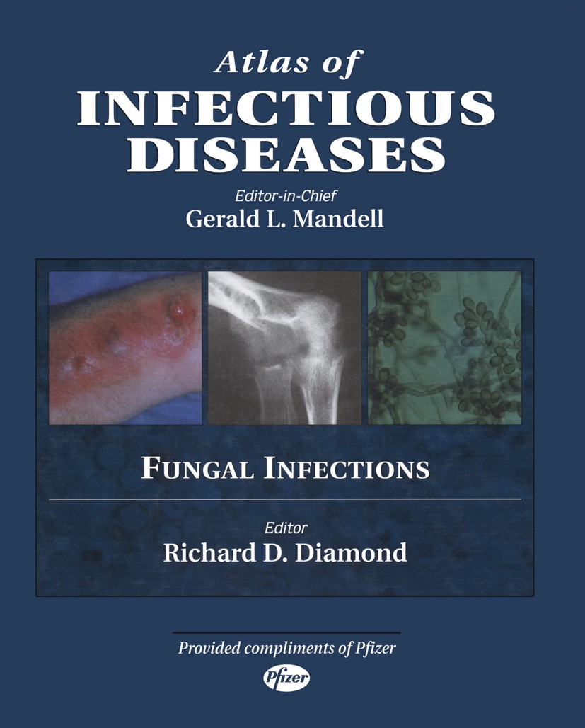 Titlebook: Atlas of Infectious Diseases; Fungal Infections Gerald L. Mandell (Chief),Richard D. Diamond Book 2000 Springer Science+Business Media New Titlebook: Atlas of Infectious Diseases; Fungal Infections Gerald L. Mandell (Chief),Richard D. Diamond Book 2000 Springer Science+Business Media New