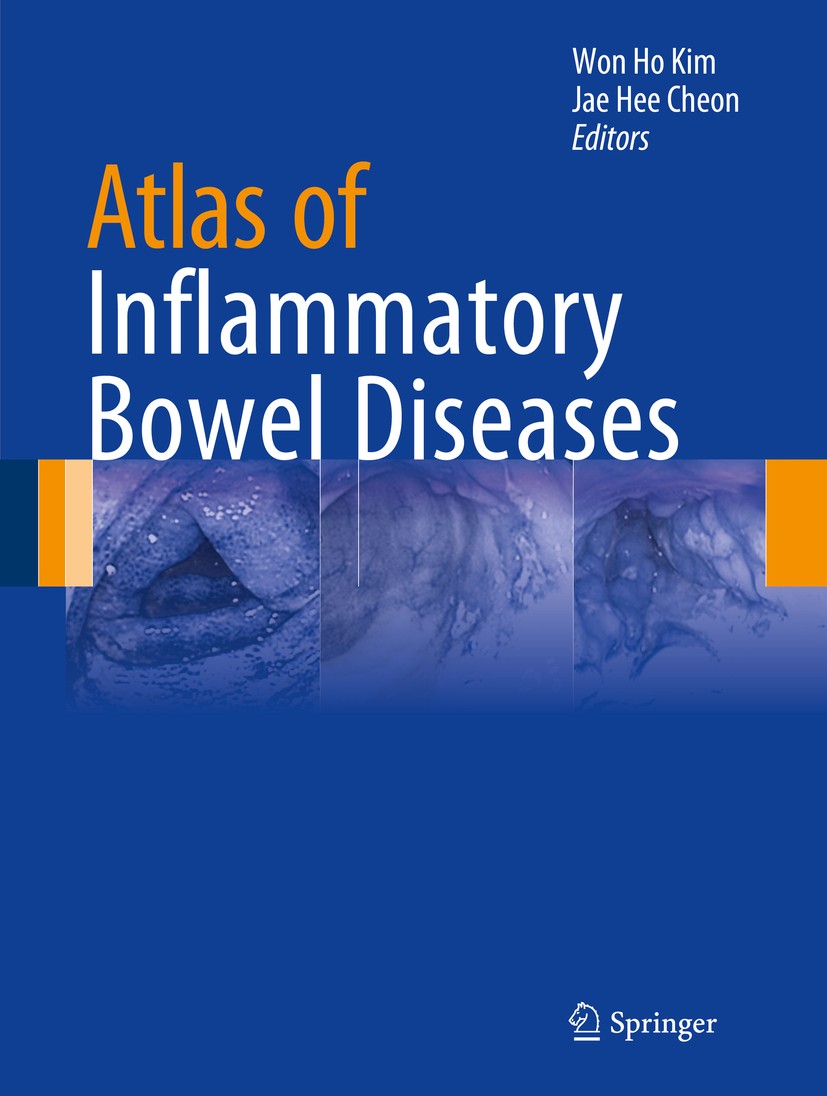 Titlebook: Atlas of Inflammatory Bowel Diseases; Won Ho Kim,Jae Hee Cheon Book 2015 Springer-Verlag Berlin Heidelberg 2015 EGD.Ileocolonoscopy.Inflam Titlebook: Atlas of Inflammatory Bowel Diseases; Won Ho Kim,Jae Hee Cheon Book 2015 Springer-Verlag Berlin Heidelberg 2015 EGD.Ileocolonoscopy.Inflam