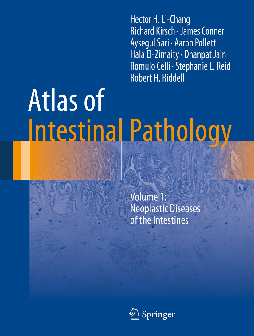 Titlebook: Atlas of Intestinal Pathology; Volume 1: Neoplastic Hector H. Li-Chang,Richard Kirsch,Robert H. Riddel Book 2019 Springer Nature Switzerlan Titlebook: Atlas of Intestinal Pathology; Volume 1: Neoplastic Hector H. Li-Chang,Richard Kirsch,Robert H. Riddel Book 2019 Springer Nature Switzerlan