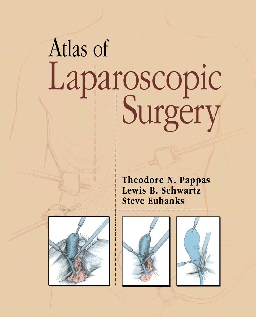 Titlebook: Atlas of Laparoscopic Surgery; Theodore N. Pappas,Lewis B. Schwartz,Steve Eubanks Book 1996 Springer Science+Business Media New York 1996 Titlebook: Atlas of Laparoscopic Surgery; Theodore N. Pappas,Lewis B. Schwartz,Steve Eubanks Book 1996 Springer Science+Business Media New York 1996