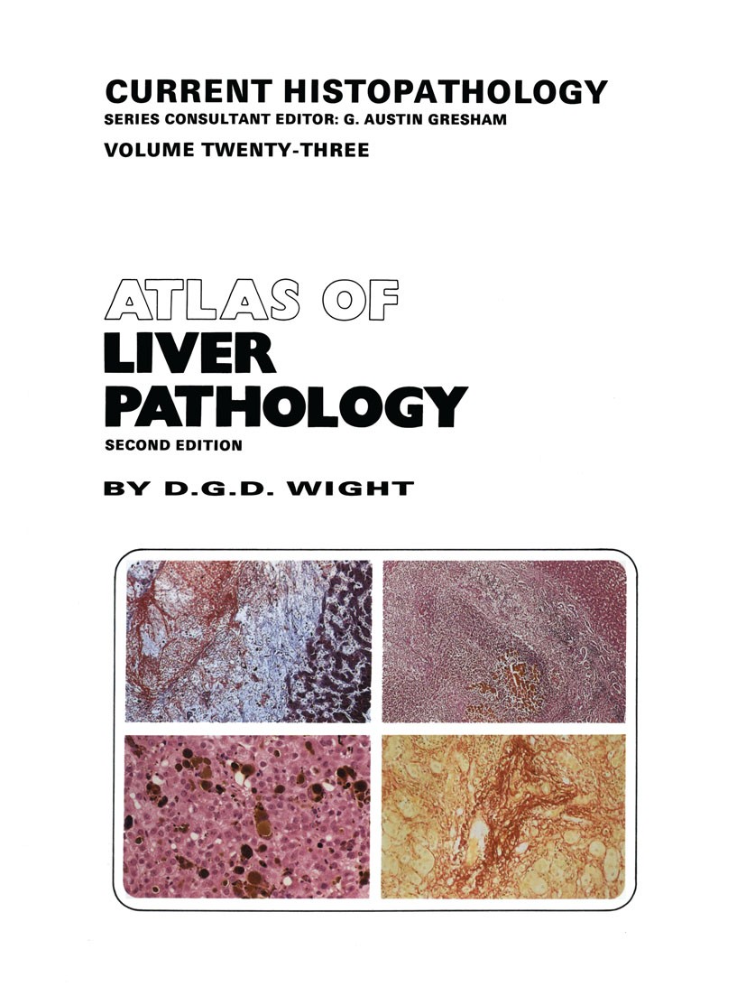 Titlebook: Atlas of Liver Pathology; D. G. D. Wight Book 1993Latest edition D. G. D. Wight 1993 biopsy.carcinoma.hepatitis.infection.liver.liver dise Titlebook: Atlas of Liver Pathology; D. G. D. Wight Book 1993Latest edition D. G. D. Wight 1993 biopsy.carcinoma.hepatitis.infection.liver.liver dise
